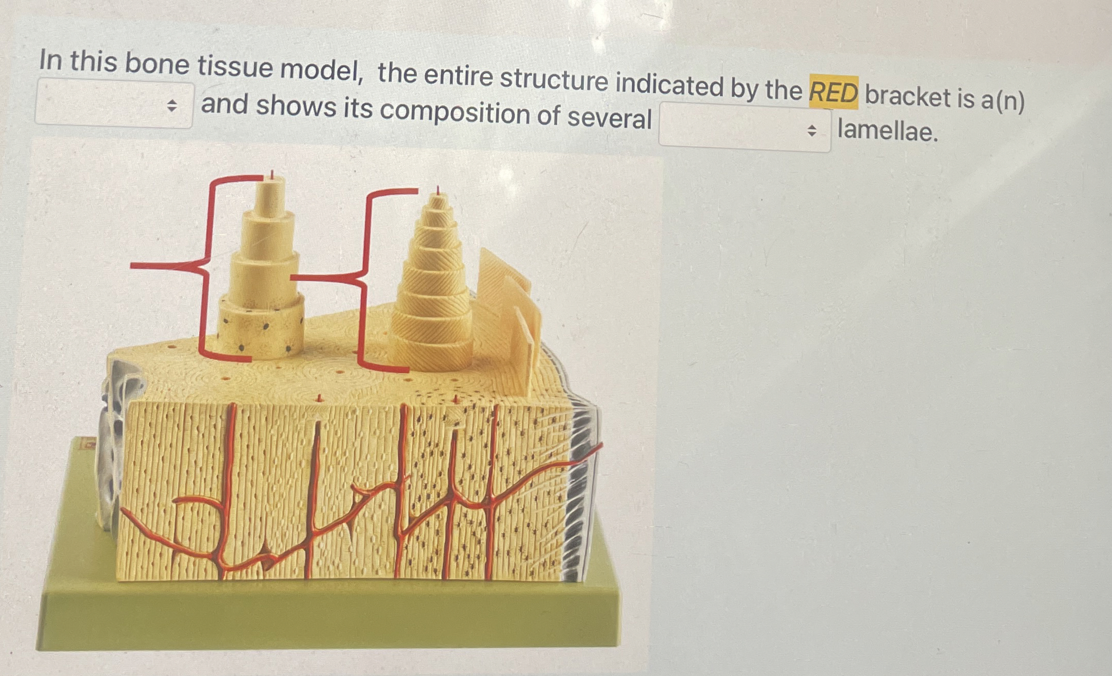 Solved In this bone tissue model, the entire structure | Chegg.com