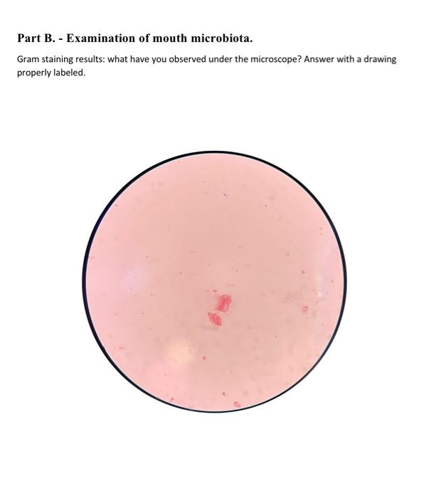 Part A. Examination of bacterial endospore by | Chegg.com