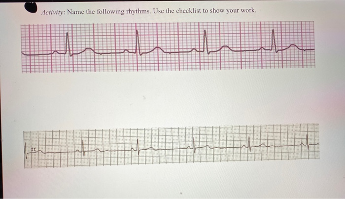 Solved 4. Label the three standard (bipolar) leads. Lead | Chegg.com