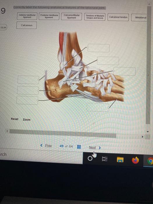 Solved Correctly label the following anatomical features of | Chegg.com