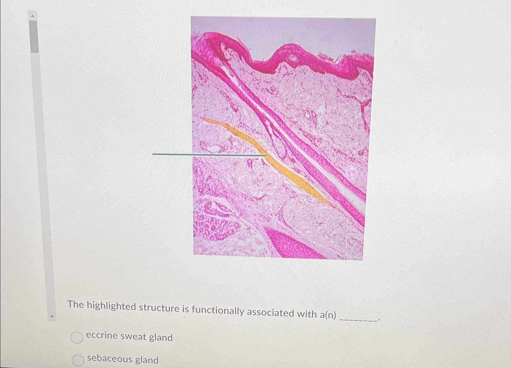 Solved The highlighted structure is functionally associated | Chegg.com