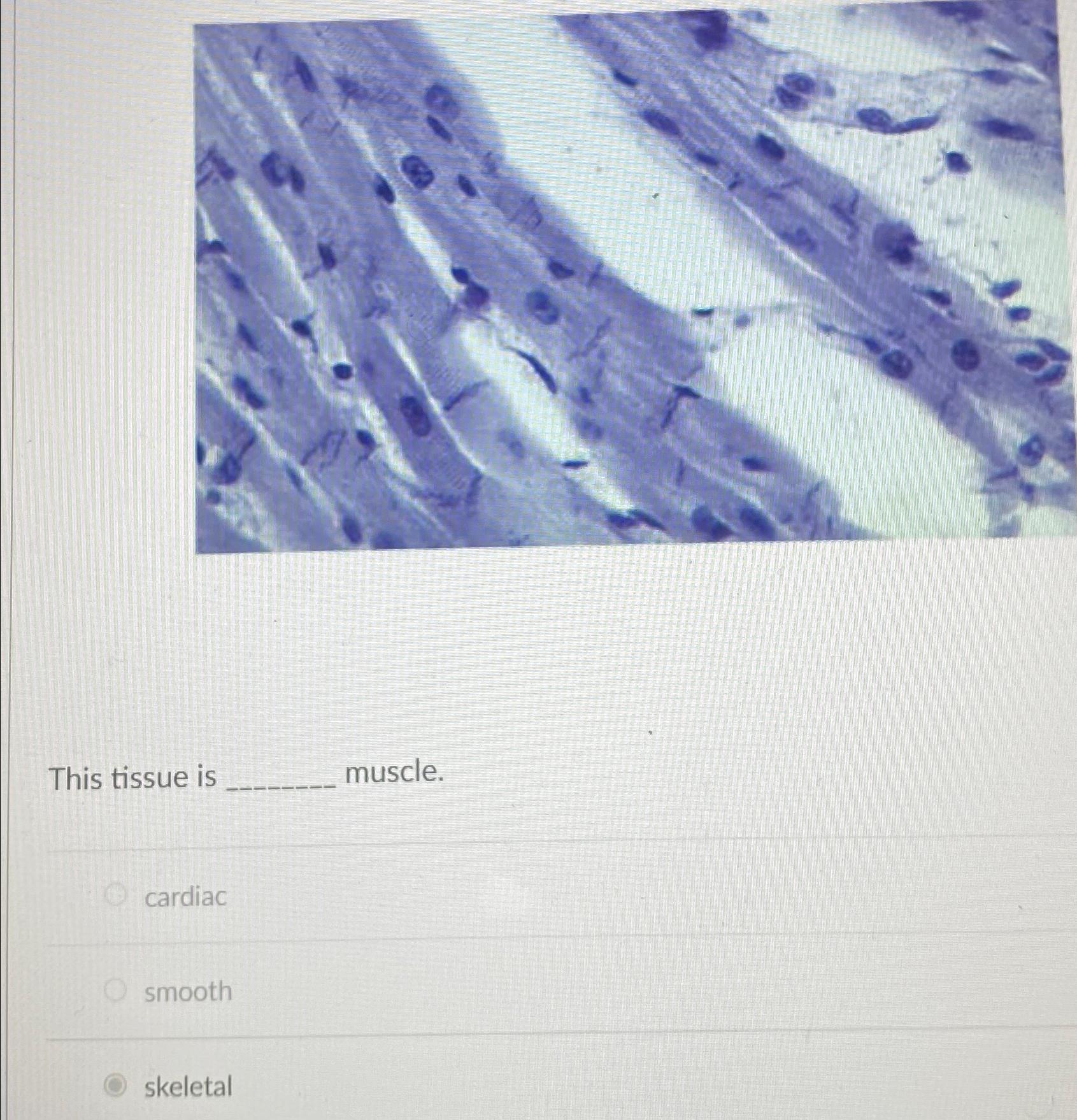 Solved This tissue is muscle.cardiacsmoothskeletal | Chegg.com