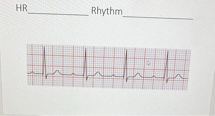 Solved HR RhythmHR RhythmHR Rhythm | Chegg.com