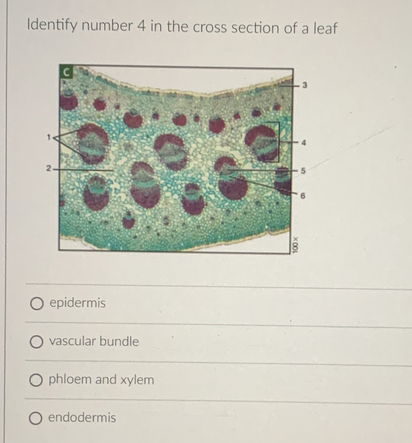 Solved Identify number 4 ﻿in the cross section of a | Chegg.com