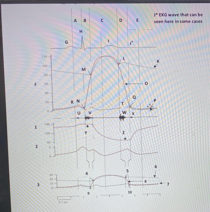 Solved C. Calculate stroke volume using the information from | Chegg.com
