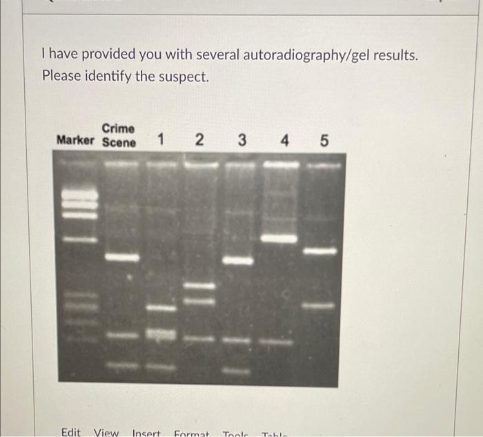 Solved I have provided you with several autoradiography/gel