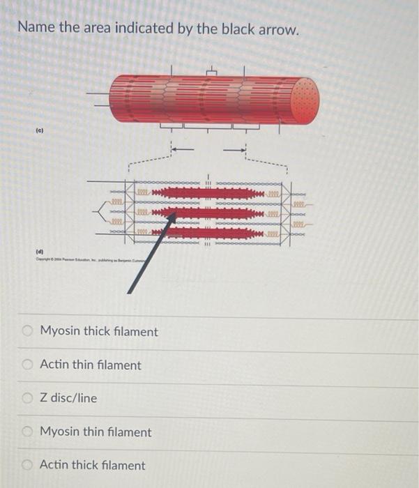 Solved Name the area indicated by the bold black bracket.