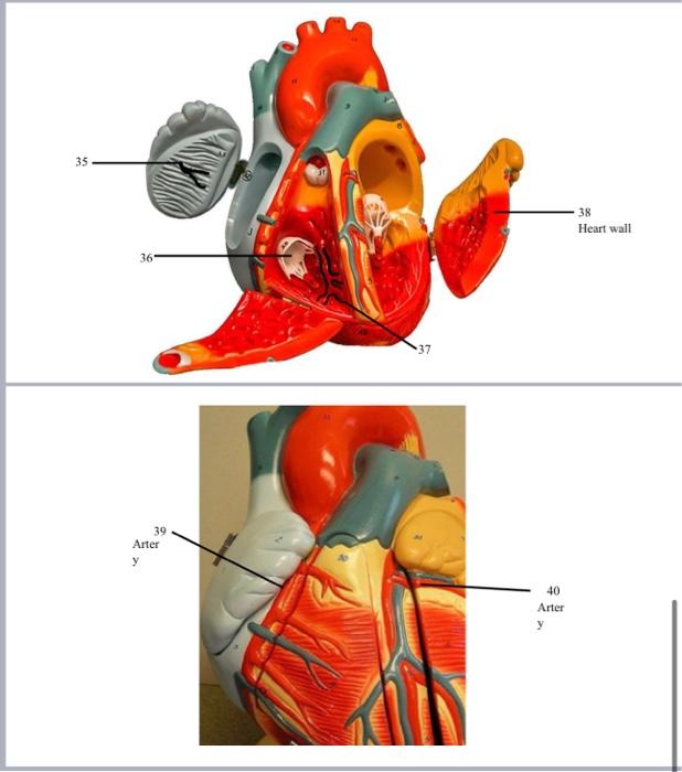 Solved 38 Heart wall