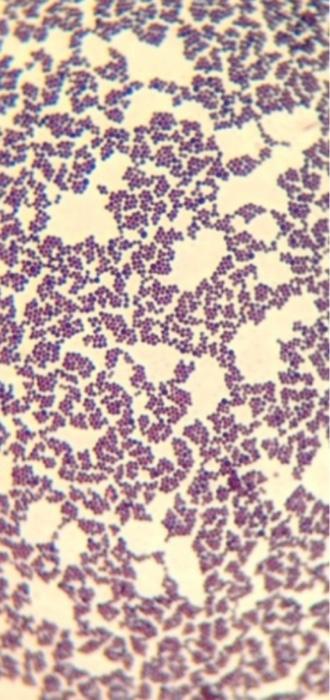 Solved 6) The figure shows the result of a Gram staining. | Chegg.com