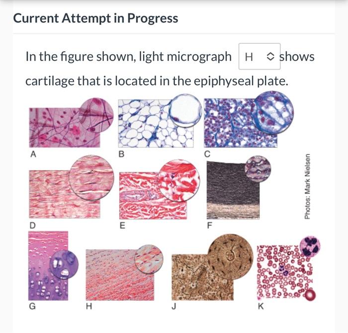 In the figure shown, light micrograph shows cartilage that is located in the epiphyseal plate.