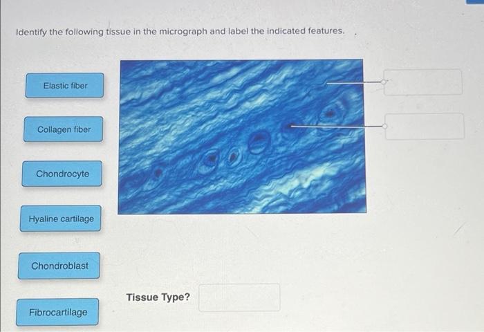 Solved Identify the following tissue in the micrograph and | Chegg.com