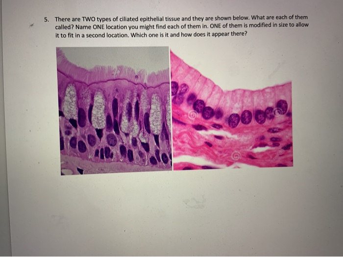 Solved 1. In the image below what type of cells are being | Chegg.com