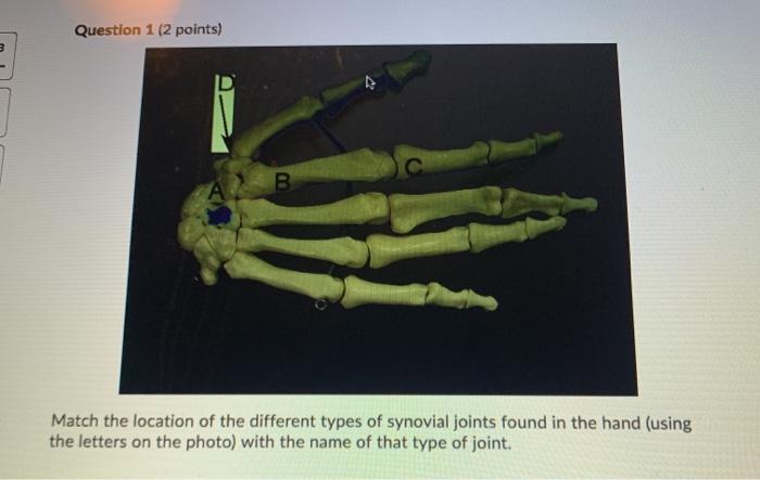 Location and types of joints [1].