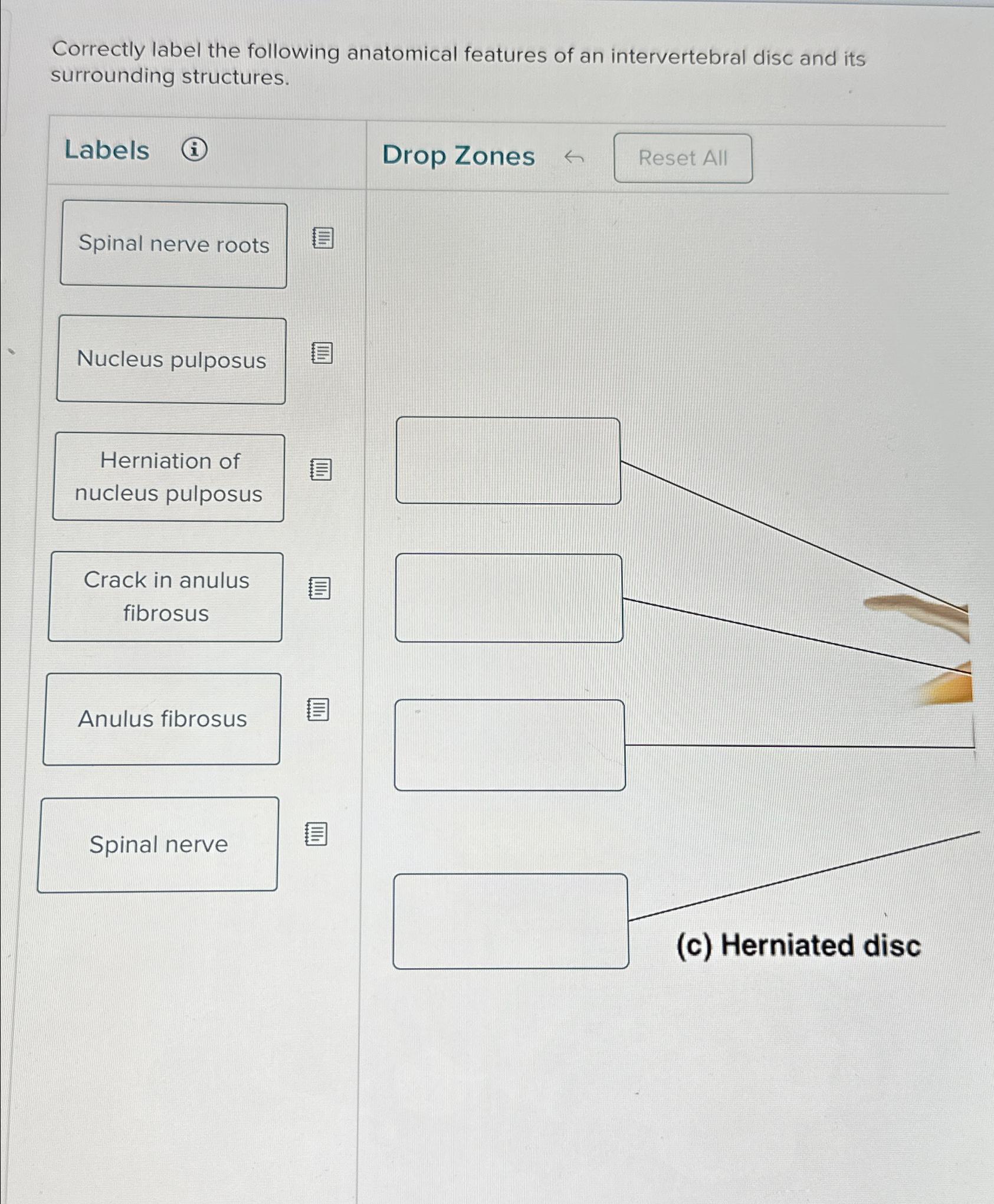 Correctly label the following anatomical features of Biology Diagrams