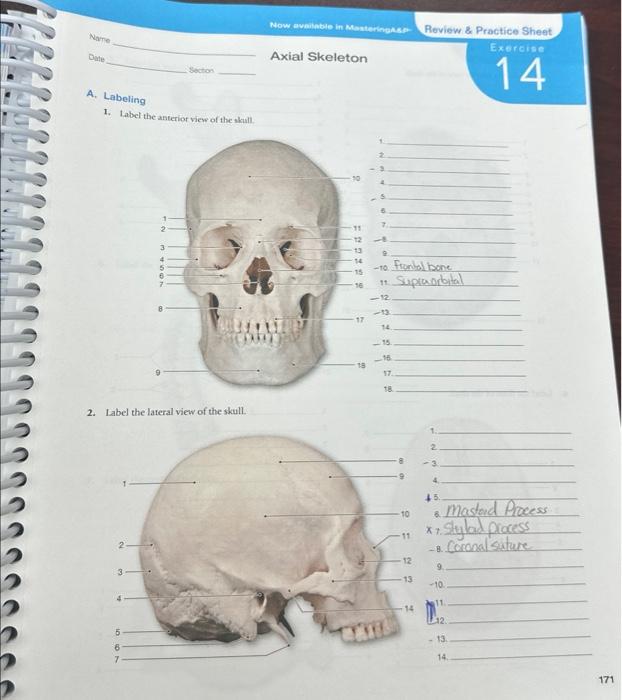 Solved A. Labeling 1. Label the anterior view of the skull. | Chegg.com