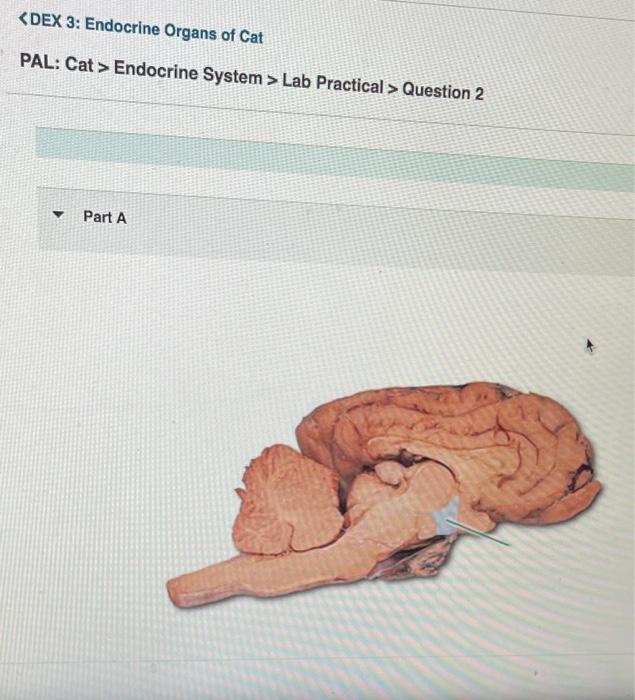 Solved > Endocrine System > Lab Practical > Question 2
