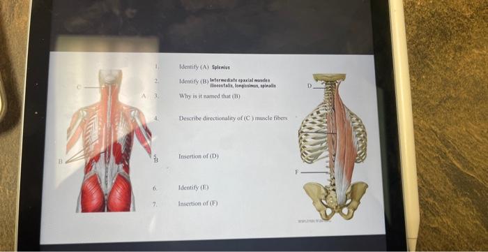 Identify (A) splenios
Identify (B) Intermediate toxrial moulet
Why is it named that (B)
Describe derectionality of \( (C) \)