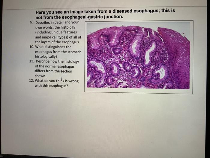 histology of esophagus and stomach