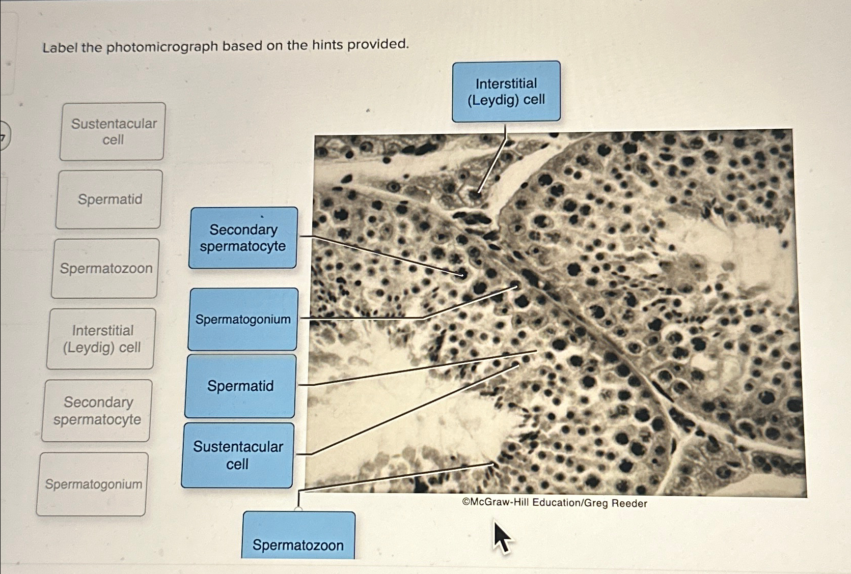 Solved Label the photomicrograph based on the hints | Chegg.com