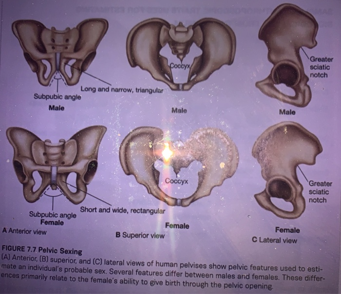 Healthy Street - 🔈 PELVIC GRIDLE SEXUAL DIFFERENCES Distinction between  male and female skeletons is most evident in the pelvic girdle. The pelvic  girdles of males and females differ in several respects.