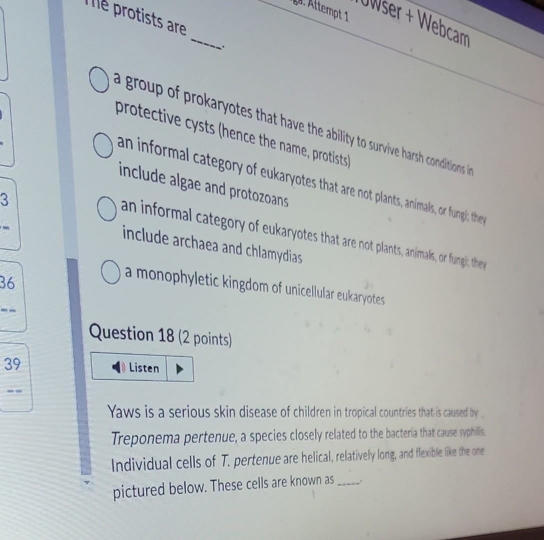 Solved 1) Listen Which statement is TRUE? Prokaryotes lack