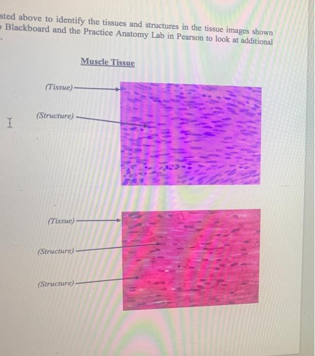Solved ested above to identify the tissues and structures in | Chegg.com