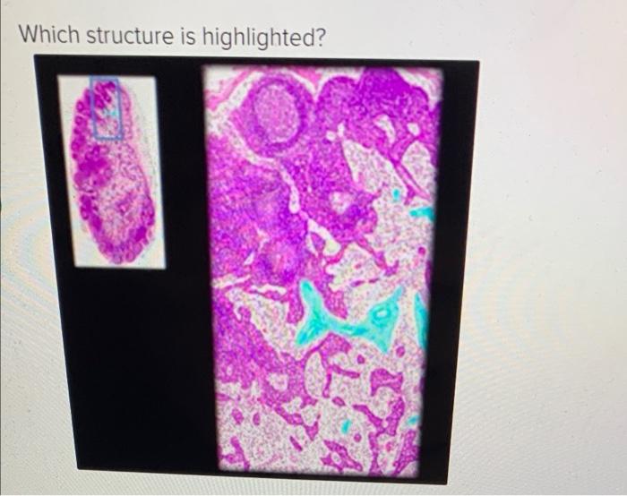 Solved Which structure is highlighted? cortex of lymph | Chegg.com