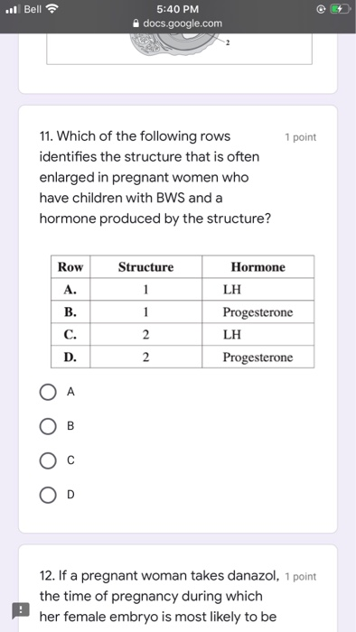 Solved A This structure enlarges during pregnancy B This