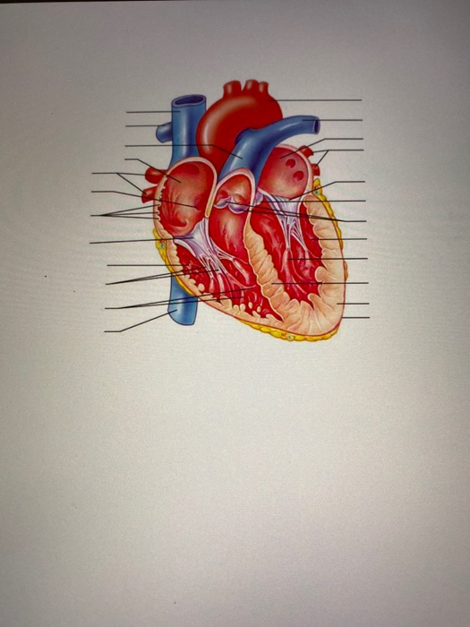 Solved (a) Anterior view | Chegg.com