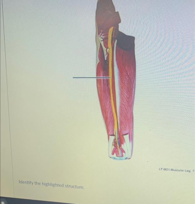 Solved LT M21 Muscular Leg? Identify the highlighted | Chegg.com