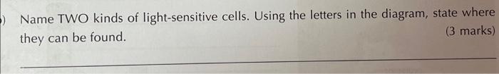contains two kinds of cells that are sensitive to light