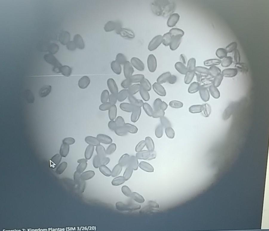 Solved Observation 5: Pollen grains... What are they? The | Chegg.com