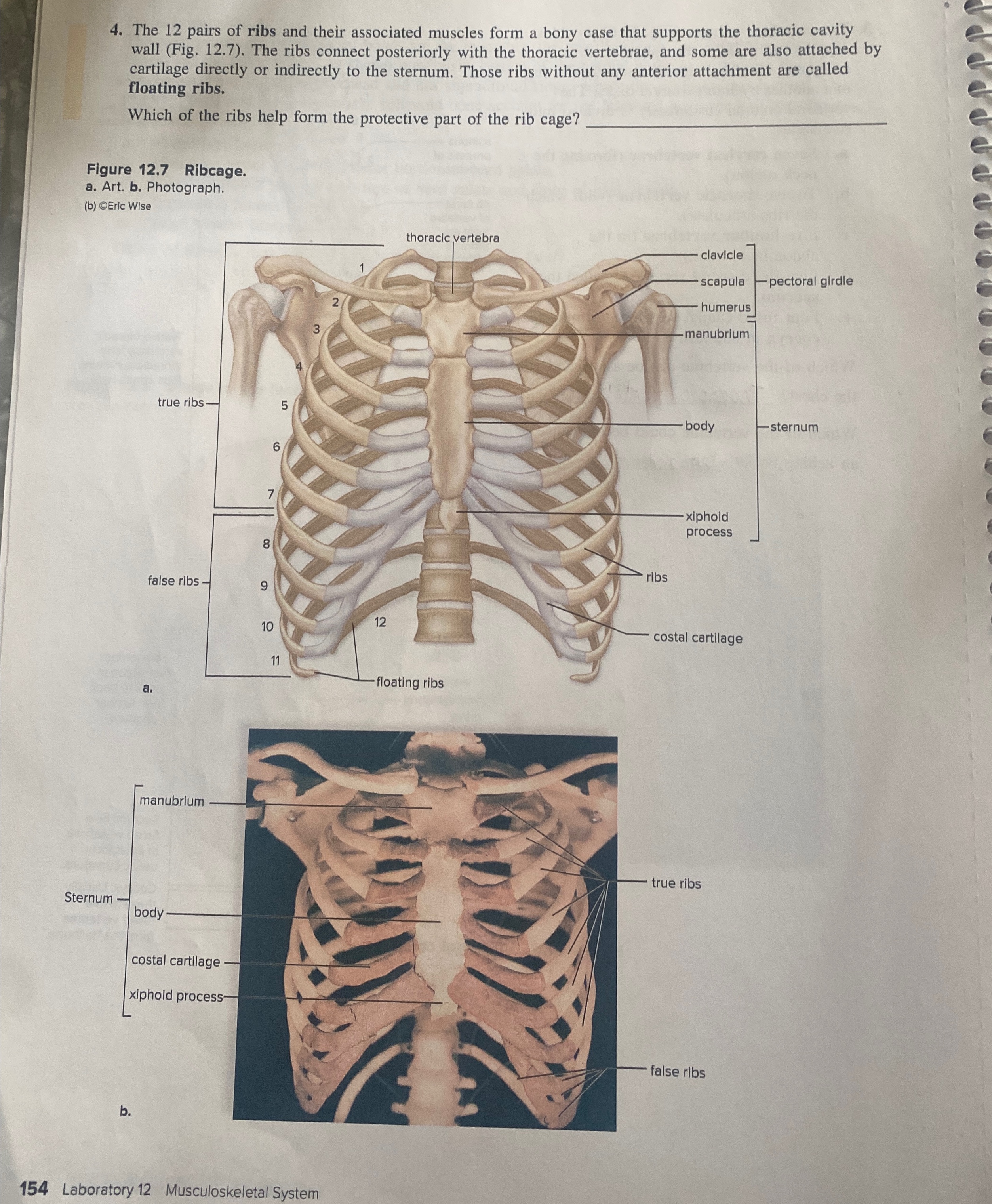 Solved The 12 ﻿pairs of ribs and their associated muscles | Chegg.com