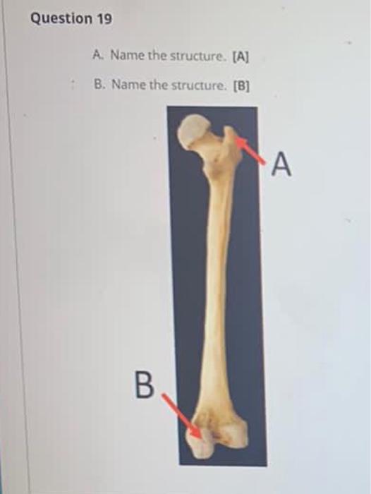 Solved Question 17 A. Name The Structure. [A] B. What Bone | Chegg.com