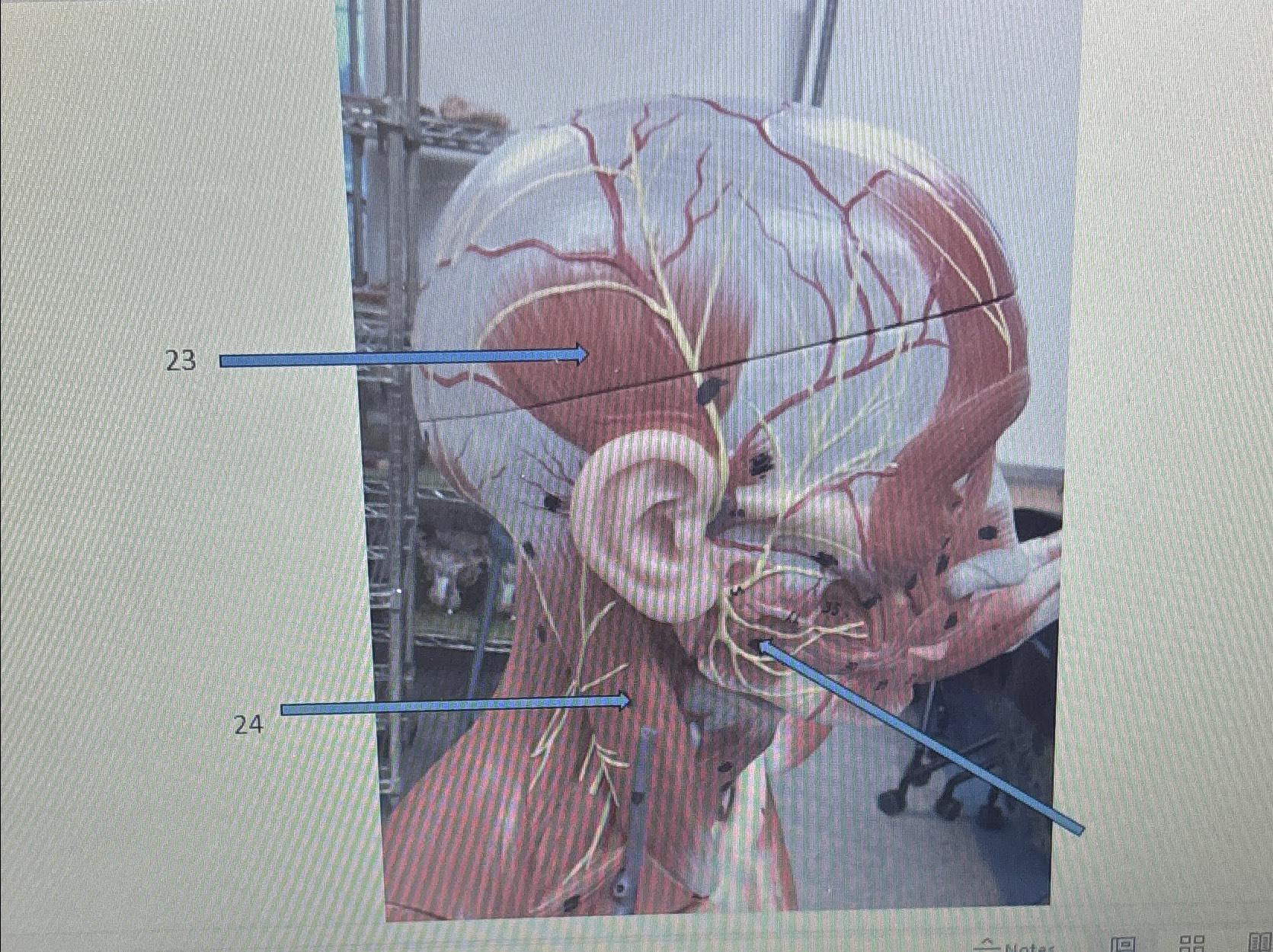 Solved Identify the structures | Chegg.com