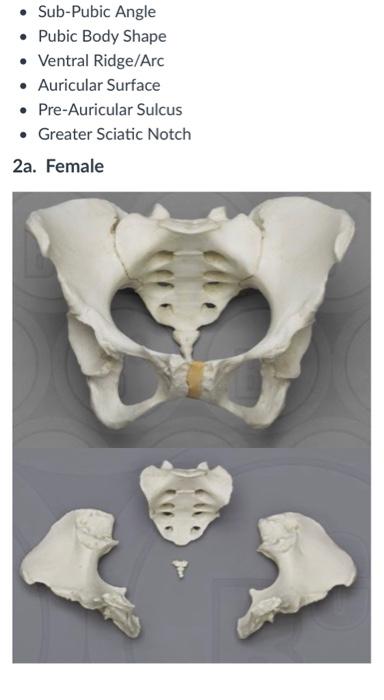 ventral arc pelvis