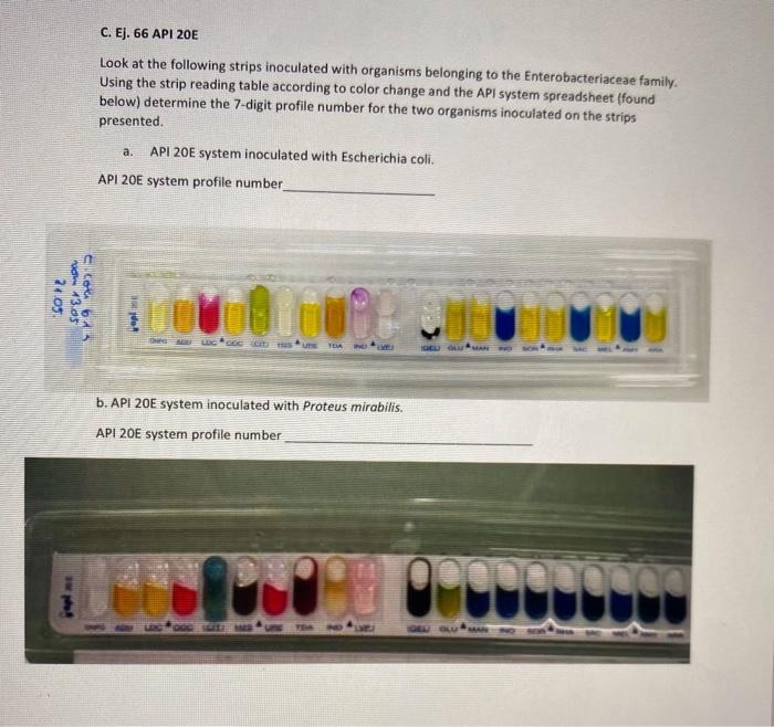 Solved C. Ej. 66 API 20E Look at the following strips | Chegg.com