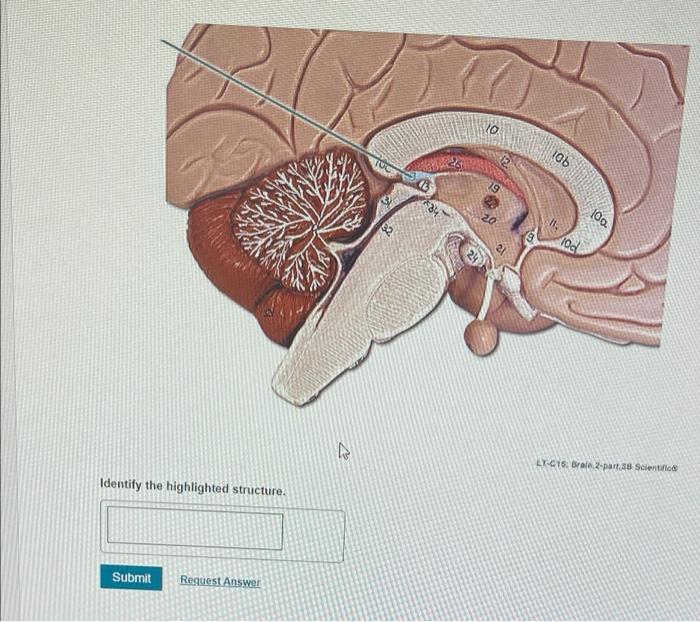 Solved Model courtesy or Ward's Natural Science | Chegg.com