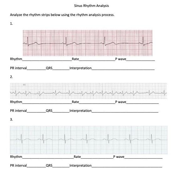 Solved Sinus Rhythm Analysis Analyze the rhythm strips below | Chegg.com