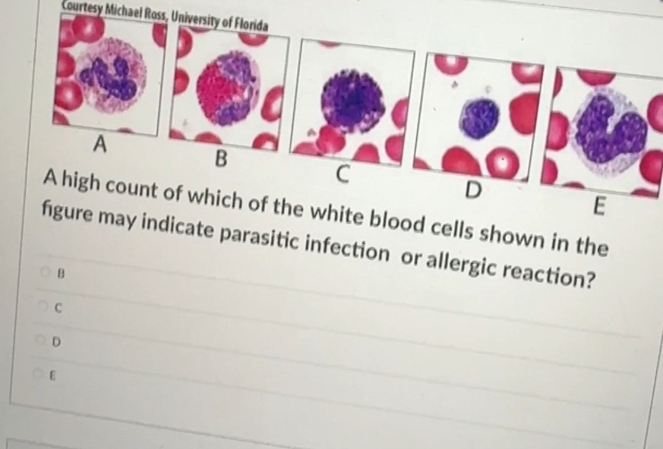 Solved A high count of which of the white blood cells shown | Chegg.com