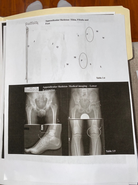 Solved Appendicular Skeleton- Tibia, Fibula and Suffolks | Chegg.com
