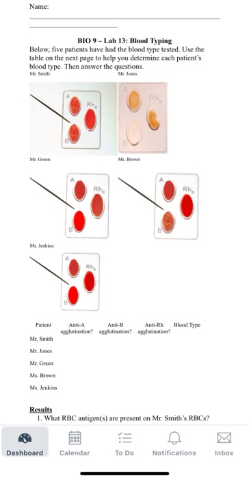 Solved Name Bio Lab Blood Typing Below Five Patients Chegg Com