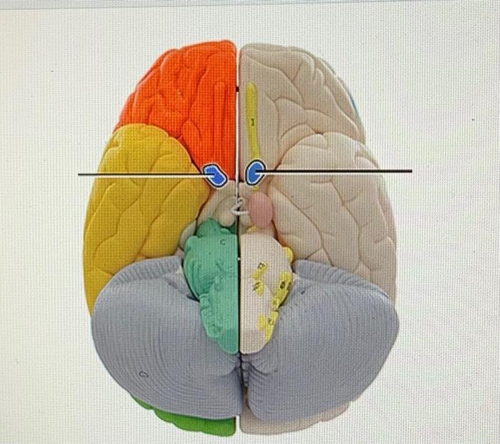 image Which Structure Is Highlighted And Indicated By The Leader Line