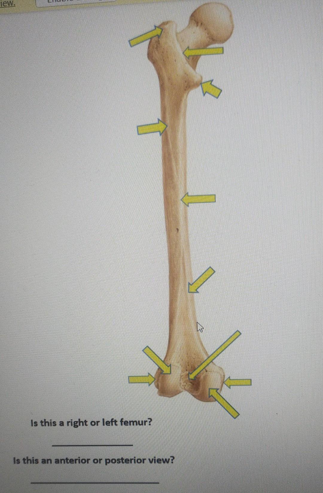 Is this an anterior or posterior view?