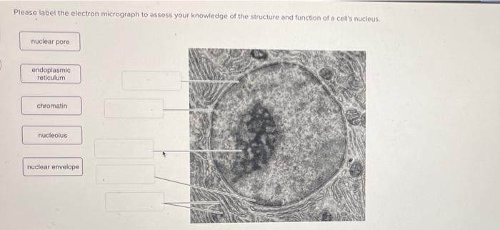 nucleolus electron micrograph