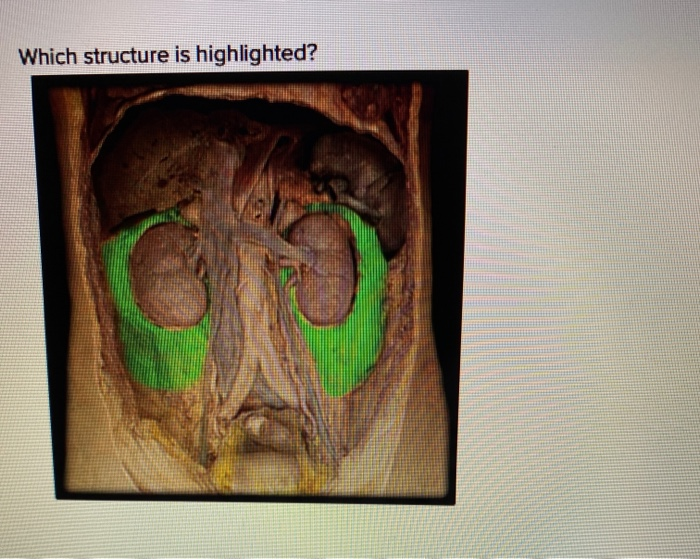 solved-which-structure-is-highlighted-pelvis-o-cortex-chegg