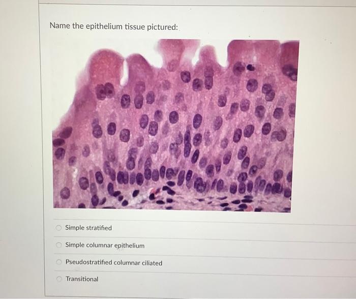 Solved Name the epithelium tissue pictured: mar LENO | Chegg.com