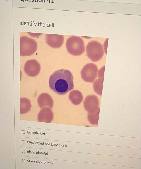 Solved the cell Lymphocyte O Nucleated red blood Chegg.com