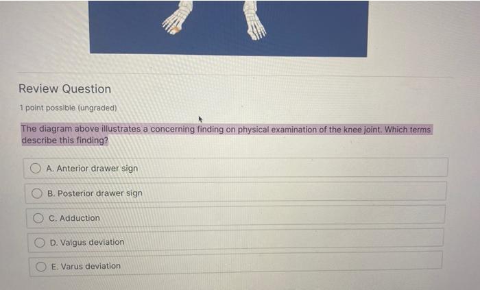 Solved Review Question 1 point possible (ungraded) The | Chegg.com