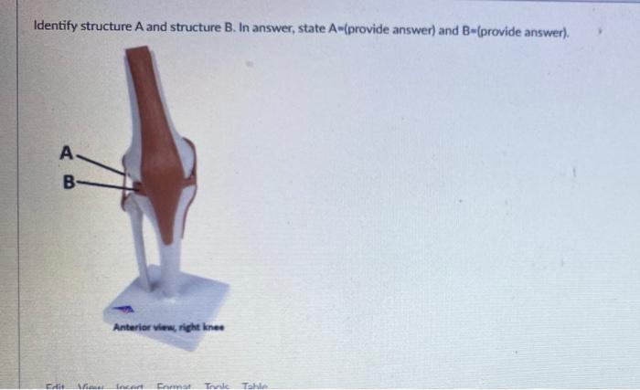 Solved Identify structure A and structure B. In answer, | Chegg.com